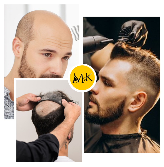 Mk hair fixing non surgical hair transplant