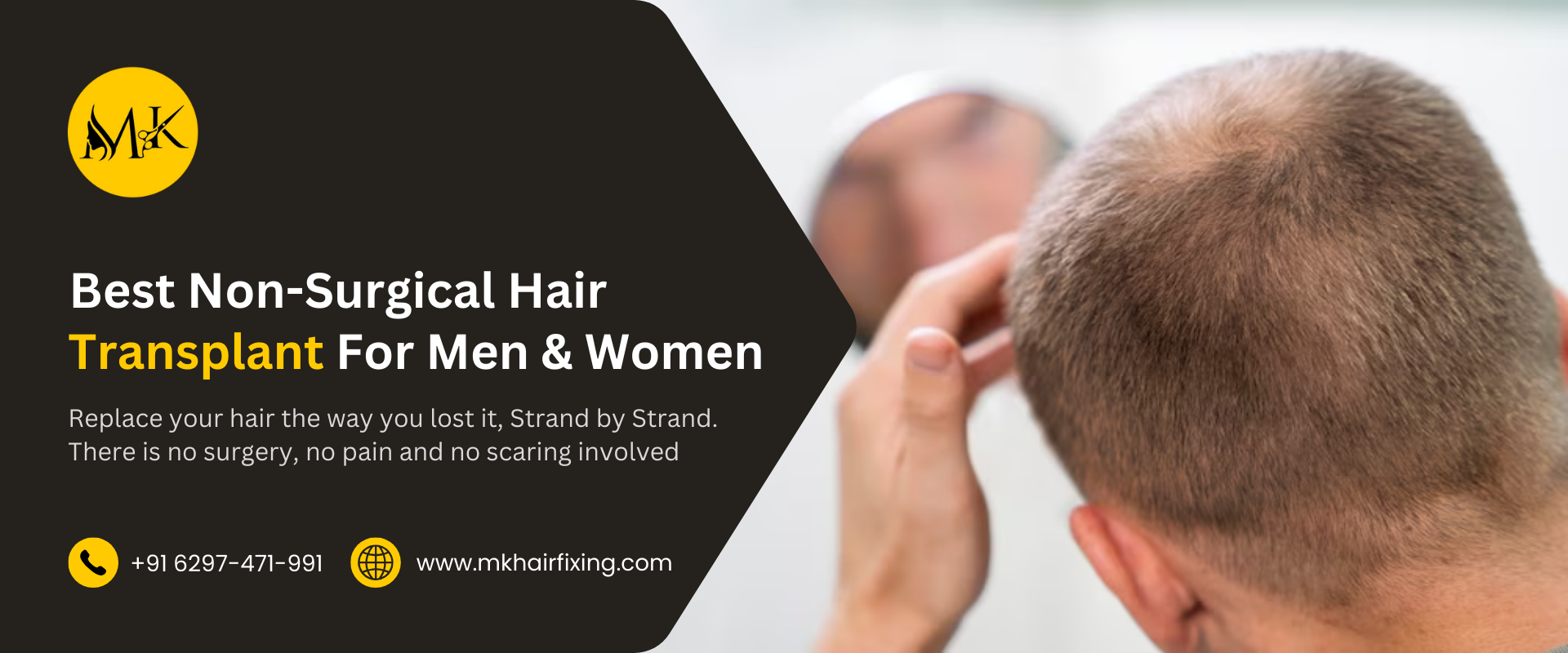Mk hair fixing non surgical hair transplant